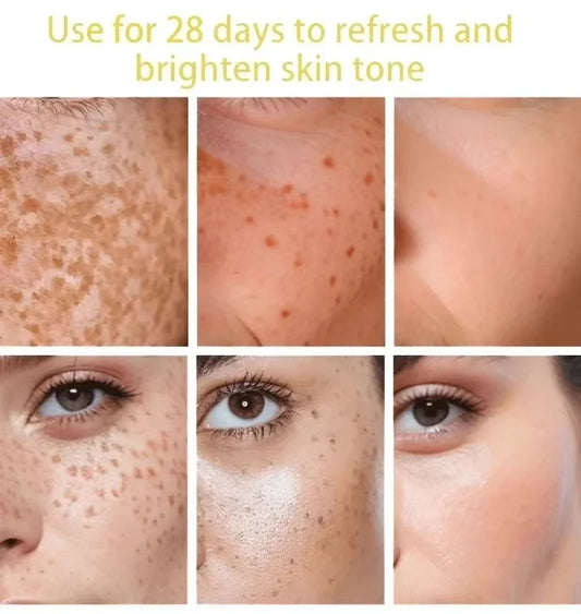 Stralende Huid Serum – Vlekken & Pigment Correctie